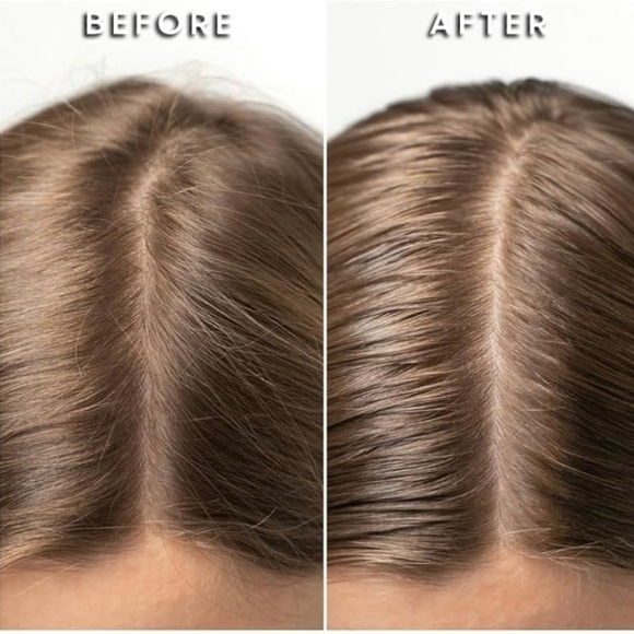 Mudmasky Vitamin-Infused Scalp Serum - Picture 6 of 9